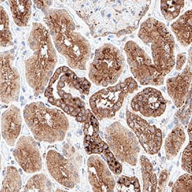 VHL was detected in immersion fixed paraffin-embedded sections of Human Kidney using Mouse Anti-Human VHL Monoclonal Antibody (Catalog # MAB114351) at 5 µg/mL for 1 hour at room temperature followed by incubation with the Anti-Mouse IgG VisUCyte™ HRP Polymer Antibody (Catalog # VC001). Before incubation with the primary antibody, tissue was subjected to heat-induced epitope retrieval using VisUCyte Antigen Retrieval Reagent-Basic (Catalog # VCTS021). Tissue was stained using DAB (brown) and counterstained with hematoxylin (blue). Specific staining was localized to cell surface in cells in convoluted tubules. View our protocol for IHC Staining with VisUCyte HRP Polymer Detection Reagents.