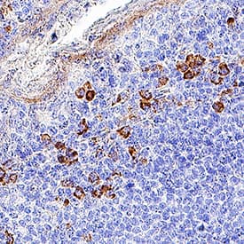 CD4 was detected in immersion fixed paraffin-embedded sections of Human Tonsil using Mouse Anti-Human CD4 Monoclonal Antibody (Catalog # MAB11436) at 5 µg/mL for 1 hour at room temperature followed by incubation with the Anti-Mouse IgG VisUCyte™ HRP Polymer Antibody (Catalog # VC001). Before incubation with the primary antibody, tissue was subjected to heat-induced epitope retrieval using VisUCyte Antigen Retrieval Reagent-Basic (Catalog # VCTS021). Tissue was stained using DAB (brown) and counterstained with hematoxylin (blue). Specific staining was localized to cell surface in lymphocytes. View our protocol for IHC Staining with VisUCyte HRP Polymer Detection Reagents.