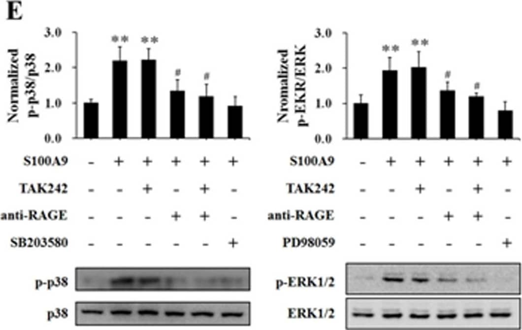 The effects of blocking TLR4 and RAGE on S100A8, S100A9 and S100A8/A9 stimulation of HUVECs.HUVECs were stimulated with S100A8 (2.0 µg/mL) (A, D), S100A9 (2.0 µg/mL) (B, E) and S100A8/A9 (2.0 µg/mL) (C, F) for 120 min with or without 60 min pre-incubation with specific blockers (TAK242 (5 µM) for TLR4 and anti-human RAGE antibody (10 µg/mL) for RAGE). Then the TER was measured (A, B and C). All data are presented as mean ± s.d. of four independent experiments. Phosphorylation of p38 (p-p38) and ERK1/2 (p-ERK1/2) were also assessed by Western blotting (D, E and F). The ratio of immunointensity between the phosphorylation of p38 and ERK1/2 (p-p38 and p-ERK) and total p38 and ERK1/2 (p38 and ERK) were calculated (D, E and F). The results are expressed in mean ± s.d. from three independent experiments. **P<0.01 vs. Control; #P<0.05 vs. S100A8/S100A9; ♣P<0.05 vs. S100A8/S100A9+TAK242+anti-RAGE. Image collected and cropped by CiteAb from the following open publication (//pubmed.ncbi.nlm.nih.gov/24595267), licensed under a CC-BY license. Not internally tested by R&D Systems.