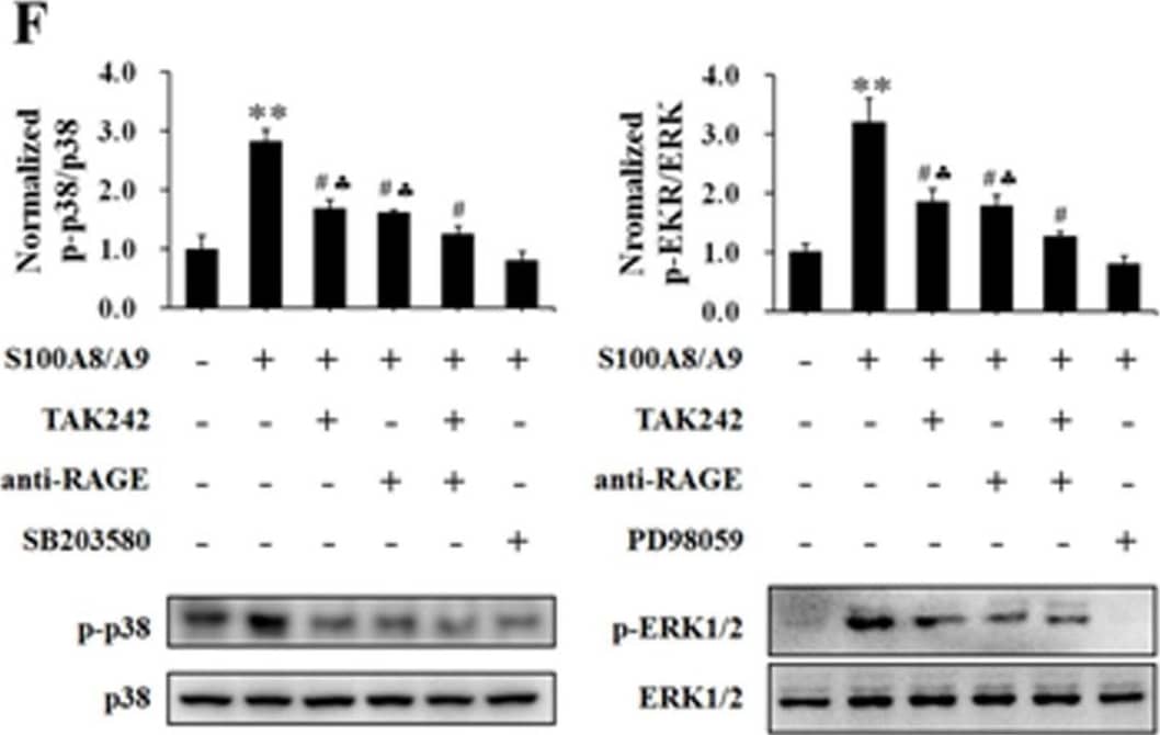 The effects of blocking TLR4 and RAGE on S100A8, S100A9 and S100A8/A9 stimulation of HUVECs.HUVECs were stimulated with S100A8 (2.0 µg/mL) (A, D), S100A9 (2.0 µg/mL) (B, E) and S100A8/A9 (2.0 µg/mL) (C, F) for 120 min with or without 60 min pre-incubation with specific blockers (TAK242 (5 µM) for TLR4 and anti-human RAGE antibody (10 µg/mL) for RAGE). Then the TER was measured (A, B and C). All data are presented as mean ± s.d. of four independent experiments. Phosphorylation of p38 (p-p38) and ERK1/2 (p-ERK1/2) were also assessed by Western blotting (D, E and F). The ratio of immunointensity between the phosphorylation of p38 and ERK1/2 (p-p38 and p-ERK) and total p38 and ERK1/2 (p38 and ERK) were calculated (D, E and F). The results are expressed in mean ± s.d. from three independent experiments. **P<0.01 vs. Control; #P<0.05 vs. S100A8/S100A9; ♣P<0.05 vs. S100A8/S100A9+TAK242+anti-RAGE. Image collected and cropped by CiteAb from the following open publication (//pubmed.ncbi.nlm.nih.gov/24595267), licensed under a CC-BY license. Not internally tested by R&D Systems.