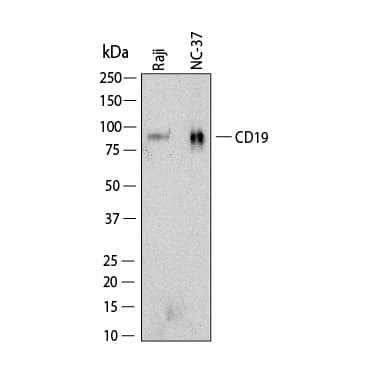 Western Blot shows lysates of Raji human Burkitt's lymphoma cell line and NC‑37 human Burkitt's lymphoma B lymphoblast cell line. PVDF membrane was probed with 2 µg/ml of Rabbit Anti-Human CD19 Monoclonal Antibody (Catalog # MAB11516) followed by HRP-conjugated Anti-Rabbit IgG Secondary Antibody (Catalog # HAF008). A specific band was detected for CD19 at approximately 95 kDa (as indicated).  This experiment was conducted under reducing conditions and using Western Blot Buffer Group 1.