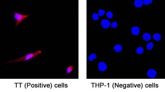 Neuronostatin was detected in fixed TT human medullary thyroid cancer cell line (Positive) and absent in THP‑1 human acute monocytic leukemia cell line (Negative) using Rabbit Anti-Human Neuronostatin Monoclonal Antibody (Catalog # MAB11554) at 3 µg/ml for 3 hours at room temperature. Cells were stained using the NorthernLights&trade; 557-conjugated Anti-Rabbit IgG Secondary Antibody (red; Catalog # NL004) and counterstained with DAPI (blue). Specific staining was localized to the cytoplasm. View our protocol for Fluorescent ICC Staining of Cells on Coverslips.