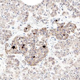 Neuronostatin was detected in immersion fixed paraffin-embedded sections of human pancreas using Rabbit Anti-Human Neuronostatin Monoclonal Antibody (Catalog # MAB11554) at 3 µg/ml for 1 hour at room temperature followed by incubation with the Anti-Rabbit IgG VisUCyte&trade; HRP Polymer Antibody (Catalog # VC003) or the HRP-conjugated Anti-Rabbit IgG Secondary Antibody (Catalog # HAF008). Before incubation with the primary antibody, tissue was subjected to heat-induced epitope retrieval using VisUCyte Antigen Retrieval Reagent-Basic (Catalog # VCTS021). Tissue was stained using DAB (brown) and counterstained with hematoxylin (blue). Specific staining was localized to the cytoplasm of islet cells. View our protocol for Chromogenic IHC Staining of Paraffin-embedded Tissue Sections.