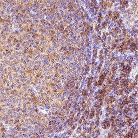 CD4 was detected in immersion fixed paraffin-embedded sections of human tonsil using Rabbit Anti-Human CD4 Monoclonal Antibody (Catalog # MAB11560) at 1 µg/ml for 1 hour at room temperature followed by incubation with the Anti-Rabbit IgG VisUCyte™ HRP Polymer Antibody (Catalog # VC003) or the HRP-conjugated Anti-Rabbit IgG Secondary Antibody (Catalog # HAF008). Before incubation with the primary antibody, tissue was subjected to heat-induced epitope retrieval using VisUCyte Antigen Retrieval Reagent-Basic (Catalog # VCTS021). Tissue was stained using DAB (brown) and counterstained with hematoxylin (blue). Specific staining was localized to the cytoplasm and membrane. View our protocol for Chromogenic IHC Staining of Paraffin-embedded Tissue Sections.