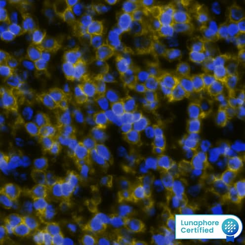 CD4 was detected in immersion fixed paraffin-embedded sections of human tonsil using Rabbit Anti-Human CD4 Monoclonal Antibody (Catalog # MAB11560) at 20µg/mL at 37 ° Celsius for 8 minutes. Before incubation with the primary antibody, tissue underwent an all-in-one dewaxing and antigen retrieval preprocessing using PreTreatment Module (PT Module) and Dewax and HIER Buffer H (pH 9). Tissue was stained using the Alexa Fluor™ Plus 647 Goat anti-Rabbit IgG Secondary Antibody at 1:200 at 37 ° Celsius for 2 minutes. (Yellow; Lunaphore Catalog # DR647RB) and counterstained with DAPI (blue; Lunaphore Catalog # DR100).Specific staining was localized to the membrane. Protocol available in COMET™ Panel Builder.