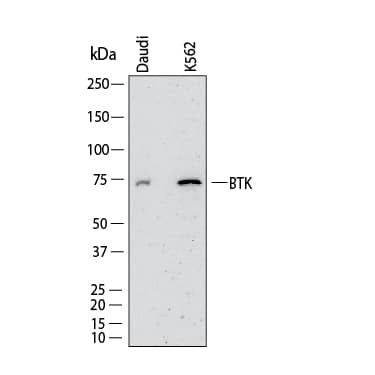 Western Blot shows lysates of Daudi human Burkitt's lymphoma cell line and K562 human chronic myelogenous leukemia cell line. PVDF membrane was probed with 2 µg/ml of Rabbit Anti-Human BTK Monoclonal Antibody (Catalog # MAB11593) followed by HRP-conjugated Anti-Rabbit IgG Secondary Antibody (Catalog # HAF008). A specific band was detected for BTK at approximately 75 kDa (as indicated).  This experiment was conducted under reducing conditions and using Western Blot Buffer Group 1.