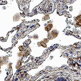 TREM2 was detected in immersion fixed paraffin-embedded sections of human lung using Rabbit Anti-Human TREM2 Monoclonal Antibody (Catalog # MAB11618) at 3 µg/ml for 1 hour at room temperature followed by incubation with the Anti-Rabbit IgG VisUCyte™ HRP Polymer Antibody (Catalog # VC003). Before incubation with the primary antibody, tissue was subjected to heat-induced epitope retrieval using VisUCyte Antigen Retrieval Reagent-Basic (Catalog # VCTS021). Tissue was stained using DAB (brown) and counterstained with hematoxylin (blue). Specific staining was localized to the cytoplasm. View our protocol for IHC Staining with VisUCyte HRP Polymer Detection Reagents.