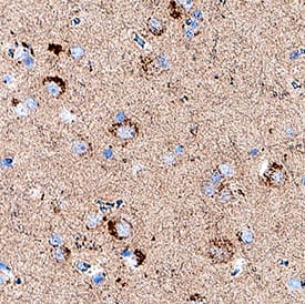 TREM2 was detected in immersion fixed paraffin-embedded sections of human brain cortex using Rabbit Anti-Human TREM2 Monoclonal Antibody (Catalog # MAB11618) at 3 µg/ml for 1 hour at room temperature followed by incubation with the Anti-Rabbit IgG VisUCyte™ HRP Polymer Antibody (Catalog # VC003). Before incubation with the primary antibody, tissue was subjected to heat-induced epitope retrieval using VisUCyte Antigen Retrieval Reagent-Basic (Catalog # VCTS021). Tissue was stained using DAB (brown) and counterstained with hematoxylin (blue). Specific staining was localized to the cytoplasm of microglia. View our protocol for IHC Staining with VisUCyte HRP Polymer Detection Reagents.