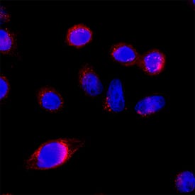 SLC1A5 was detected in immersion fixed SW480 human colorectal adenocarcinoma cell line using Rabbit Anti-Human SLC1A5 Monoclonal Antibody (Catalog # MAB11628) at 3 µg/ml for 3 hours at room temperature. Cells were stained using the NorthernLights™ 557-conjugated Anti-Rabbit IgG Secondary Antibody (red; Catalog # NL004) and counterstained with DAPI (blue). Specific staining was localized to the cell surface. View our protocol for Fluorescent ICC Staining of Cells on Coverslips.