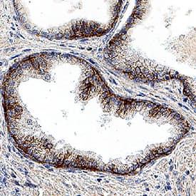 SLC1A5 was detected in immersion fixed paraffin-embedded sections of human prostate using Rabbit Anti-Human SLC1A5 Monoclonal Antibody (Catalog # mab11628) at 3 µg/ml for 1 hour at room temperature followed by incubation with the Anti-Rabbit IgG VisUCyte™ HRP Polymer Antibody (Catalog # VC003). Before incubation with the primary antibody, tissue was subjected to heat-induced epitope retrieval using VisUCyte Antigen Retrieval Reagent-Basic (Catalog # VCTS021). Tissue was stained using DAB (brown) and counterstained with hematoxylin (blue). Specific staining was localized to the cell surface. View our protocol for IHC Staining with VisUCyte HRP Polymer Detection Reagents.