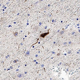 Somatostatin was detected in immersion fixed paraffin-embedded sections of human hypothalamus using Rabbit Anti-Human Somatostatin Monoclonal Antibody (Catalog # MAB11635) at 3 µg/ml for 1 hour at room temperature followed by incubation with the Anti-Rabbit IgG VisUCyte™ HRP Polymer Antibody (Catalog # VC003). Before incubation with the primary antibody, tissue was subjected to heat-induced epitope retrieval using VisUCyte Antigen Retrieval Reagent-Basic (Catalog # VCTS021). Tissue was stained using DAB (brown) and counterstained with hematoxylin (blue). Specific staining was localized to the cytoplasm . View our protocol for IHC Staining with VisUCyte HRP Polymer Detection Reagents.