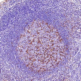 PD‑1 was detected in immersion fixed paraffin-embedded sections of human tonsil using Rabbit Anti-Human PD‑1 Monoclonal Antibody (Catalog # MAB11638) at 3 µg/ml for 1 hour at room temperature followed by incubation with the Anti-Rabbit IgG VisUCyte™ HRP Polymer Antibody (Catalog # VC003). Before incubation with the primary antibody, tissue was subjected to heat-induced epitope retrieval using VisUCyte Antigen Retrieval Reagent-Basic (Catalog # VCTS021). Tissue was stained using DAB (brown) and counterstained with hematoxylin (blue). Specific staining was localized to the cell surface. View our protocol for IHC Staining with VisUCyte HRP Polymer Detection Reagents.