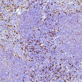 S100A4 was detected in immersion fixed paraffin-embedded sections of mouse spleen using Rat Anti-Mouse S100A4 Monoclonal Antibody (Catalog # MAB11673) at 5 µg/ml overnight at 4 °C. Before incubation with the primary antibody, tissue was subjected to heat-induced epitope retrieval using VisUCyte Antigen Retrieval Reagent-Basic (Catalog # VCTS021). Tissue was stained using the HRP-conjugated Anti-Rat IgG Secondary Antibody (Catalog # HAF005) and counterstained with hematoxylin (blue). Specific staining was localized to the nucleus and cytoplasm. View our protocol for Chromogenic IHC Staining of Paraffin-embedded Tissue Sections.