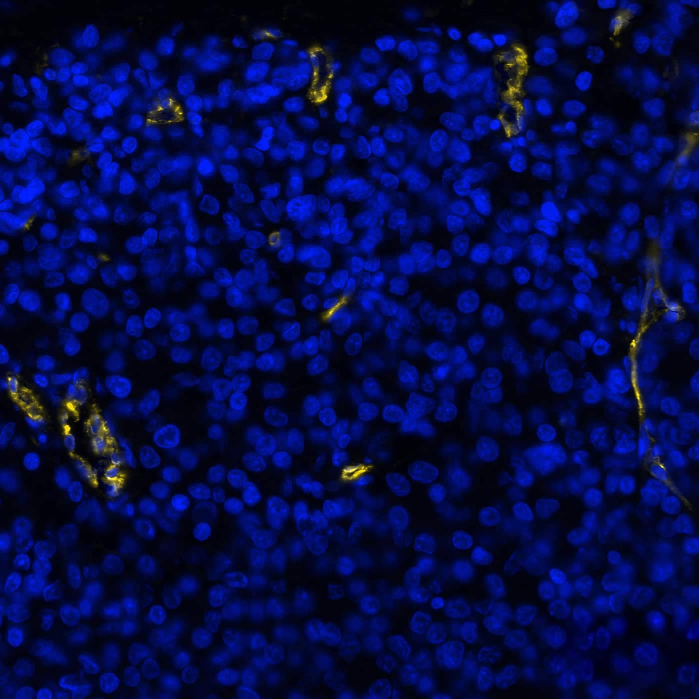 CD31 Antibody was detected in immersion fixed paraffin-embedded sections of human Prostate Cancer using Rabbit Anti-Human CD31, Monoclonal Antibody (Catalog #MAB11678) at 8ug/mL at 37° Celsius for 2 minutes. Before incubation with the primary antibody, tissue underwent an all-in-one dewaxing and antigen retrieval preprocessing using PreTreatment Module (PT Module) and Dewax and HIER Buffer H (pH 9; Epredia Catalog # TA-999-DHBH). Tissue was stained using the Alexa Fluor™ Plus 555 Goat anti-Rabbit IgG Secondary Antibody at 1:100 at 37 ° Celsius for 2 minutes. (Yellow; Lunaphore Catalog # DR555RB) and counterstained with DAPI (blue; Lunaphore Catalog # DR100). Specific staining was localized to the membrane of endothelial cells. Protocol available in COMET™ Panel Builder.​​