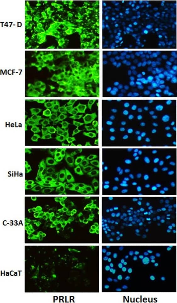 PRLR expression in human cervical cancer cells. SiHa, C-33A, HeLa (Cervical cancer cells) and control cells MCF-7, T-47D (breast cancer), HaCaT (Inmortalized human keratinocytes) were cultured in DMEM or RPMI medium containing 10% FBS. A) PRLR protein was determined by western blot using a specific antibody against the PRLR, PRLR proteins were identified by their size. B) Demonstration of the arbitrary optical density measurements from Western immunoblots assessing PRLR levels. C) The cells grown on coverslips were fixed, and the localization of PRLR (green) was observed by inmunocitochemistry using a secondary antibody conjugated with Alexa fluor 488 and DAPI stain (blue) to visualize the presence of cells. Magnification 10 x. D) Relative expression of PRLR mRNA was measure by quantitative RT-PCR. Image collected and cropped by CiteAb from the following publication (//cancerci.biomedcentral.com/articles/10.1186/1475-2867-13-103), licensed under a CC-BY license. Not internally tested by R&D Systems.