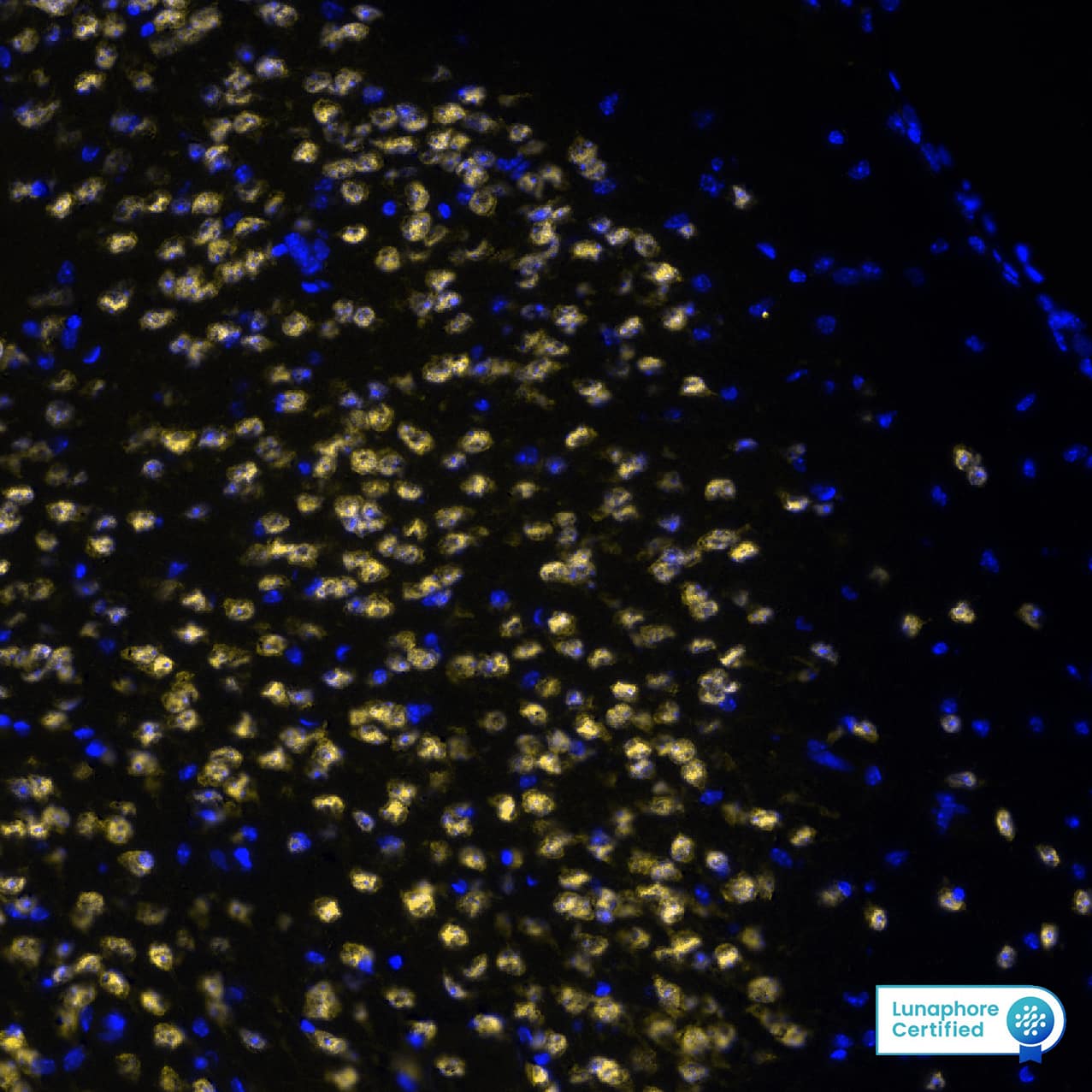 RBFOX3 was detected in perfusion fixed-frozen sections of mouse Hippocampus using Rabbit Anti-Mouse RBFOX3, Monoclonal Antibody (Catalog# MAB11690) at 5ug/mL at 27° Celsius for 4 minutes. Before incubation with the primary antibody, tissue underwent preprocessing by incubating tissue with Multi Staining Buffer (Lunaphore Catalog # BU06) for 5minutes at room temperature followed by a 20 minute incubation in Tris-Buffered Saline + 0.2% Triton at room temperature. Tissue was stained using the Alexa Fluor™ Plus 555 Goat anti-Rabbit IgG Secondary Antibody at 1:100 at 37 ° Celsius for 2 minutes. (Yellow; Lunaphore Catalog # DR555RB) and counterstained with DAPI (blue; Lunaphore Catalog # DR100). Specific staining was localized to the cytoplasm and nucleus. Protocol available in COMET™ Panel Builder.