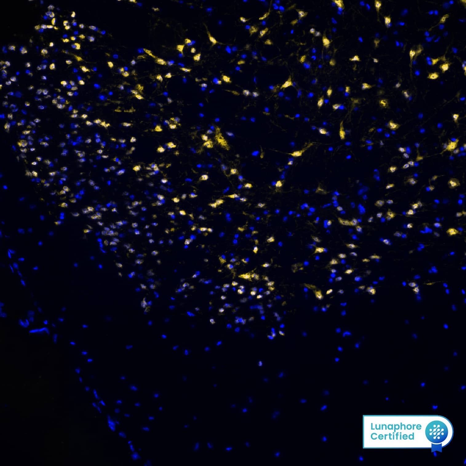 RBFOX3 was detected in perfusion fixed-frozen sections of mouse Spinal Cord using Rabbit Anti-Mouse RBFOX3, Monoclonal Antibody (Catalog# MAB11690) at 5ug/mL at 27° Celsius for 4 minutes. Before incubation with the primary antibody, tissue underwent preprocessing by incubating tissue with Multi Staining Buffer (Lunaphore Catalog # BU06) for 5minutes at room temperature followed by a 20 minute incubation in Tris-Buffered Saline + 0.2% Triton at room temperature. Tissue was stained using the Alexa Fluor™ Plus 555 Goat anti-Rabbit IgG Secondary Antibody at 1:100 at 37 ° Celsius for 2 minutes. (Yellow; Lunaphore Catalog # DR555RB) and counterstained with DAPI (blue; Lunaphore Catalog # DR100). Specific staining was localized to the cytoplasm and nucleus. Protocol available in COMET™ Panel Builder.