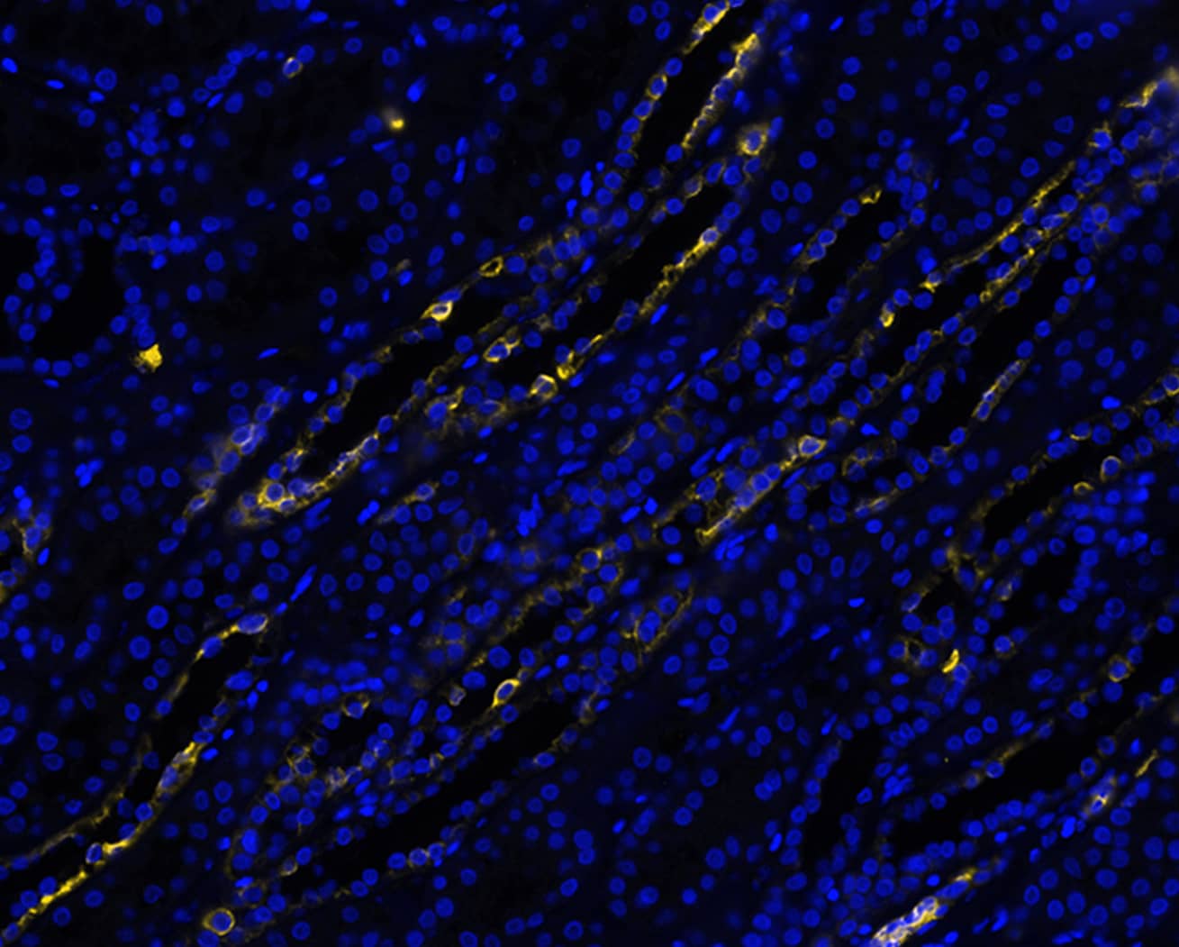 Cytokeratin 7 was detected in immersion fixed paraffin-embedded sections of human kidney using Rabbit Anti-Human KRT7, Monoclonal Antibody (Catalog# MAB11701) at 1ug/mL at 37 ° Celsius for 4 minutes. Before incubation with the primary antibody, tissue underwent an all-in-one dewaxing and antigen retrieval preprocessing using PreTreatment Module (PT Module)and Dewax and HIER Buffer H (pH 9; Epredia Catalog #TA-999-DHBH). Tissue was stained using the Alexa Fluor™ Plus 647 Goat anti-Rabbit IgG Secondary Antibody at 1:200 at 37 ° Celsius for 2 minutes. (Yellow; Lunaphore Catalog # DR647RB) and counterstained with DAPI (blue; Lunaphore Catalog # DR100). Specific staining was localized to the cytoplasm. Protocol available in COMET™ Panel Builder.