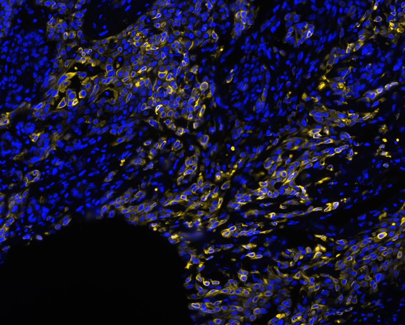 Cytokeratin 7 was detected in immersion fixed paraffin-embedded sections of human pancreas using Rabbit Anti-Human KRT7, Monoclonal Antibody (Catalog# MAB11701) at 1ug/mL at 37 ° Celsius for 4 minutes. Before incubation with the primary antibody, tissue underwent an all-in-one dewaxing and antigen retrieval preprocessing using PreTreatment Module (PT Module)and Dewax and HIER Buffer H (pH 9; Epredia Catalog #TA-999-DHBH). Tissue was stained using the Alexa Fluor™ Plus 647 Goat anti-Rabbit IgG Secondary Antibody at 1:200 at 37 ° Celsius for 2 minutes. (Yellow; Lunaphore Catalog # DR647RB) and counterstained with DAPI (blue; Lunaphore Catalog # DR100). Specific staining was localized to the cytoplasm. Protocol available in COMET™ Panel Builder.