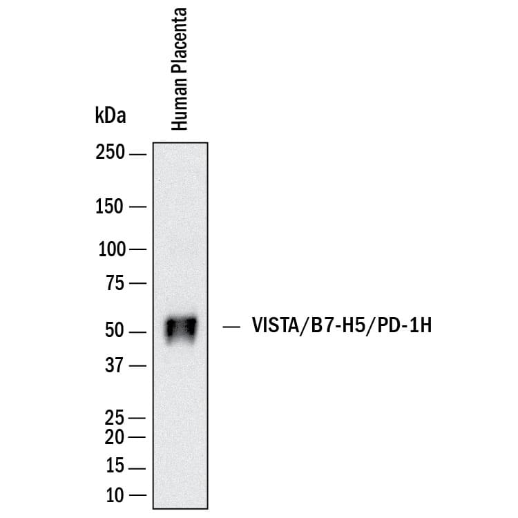 Western Blot shows lysates of human placenta. PVDF membrane was probed with 2 µg/ml of Rabbit Anti-Human VISTA/B7-H5/PD-1H Monoclonal Antibody (Catalog # MAB11704) followed by HRP-conjugated Anti-Rabbit IgG Secondary Antibody (Catalog # HAF008). A specific band was detected for VISTA/B7-H5/PD-1H at approximately 55 kDa (as indicated).  This experiment was conducted under reducing conditions and using Western Blot Buffer Group 1.