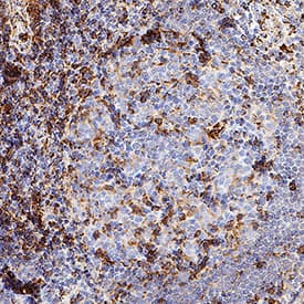 VISTA/B7-H5/PD-1H was detected in immersion fixed paraffin-embedded sections of human lymph node using Rabbit Anti-Human VISTA/B7-H5/PD-1H Monoclonal Antibody (Catalog # MAB11712) at 0.5 µg/ml for 1 hour at room temperature followed by incubation with the Anti-Rabbit IgG VisUCyte&trade; HRP Polymer Antibody (Catalog # VC003) or the HRP-conjugated Anti-Rabbit IgG Secondary Antibody (Catalog # HAF008). Before incubation with the primary antibody, tissue was subjected to heat-induced epitope retrieval using VisUCyte Antigen Retrieval Reagent-Basic (Catalog # VCTS021). Tissue was stained using DAB (brown) and counterstained with hematoxylin (blue). Specific staining was localized to the cell surface. View our protocol for IHC Staining with VisUCyte HRP Polymer Detection Reagents.