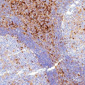 VISTA/B7-H5/PD-1H was detected in immersion fixed paraffin-embedded sections of human tonsil using Rabbit Anti-Human VISTA/B7-H5/PD-1H Monoclonal Antibody (Catalog # MAB11712) at 0.5 µg/ml for 1 hour at room temperature followed by incubation with the Anti-Rabbit IgG VisUCyte&trade; HRP Polymer Antibody (Catalog # VC003) or the HRP-conjugated Anti-Rabbit IgG Secondary Antibody (Catalog # HAF008). Before incubation with the primary antibody, tissue was subjected to heat-induced epitope retrieval using VisUCyte Antigen Retrieval Reagent-Basic (Catalog # VCTS021). Tissue was stained using DAB (brown) and counterstained with hematoxylin (blue). Specific staining was localized to the cell surface. View our protocol for IHC Staining with VisUCyte HRP Polymer Detection Reagents.