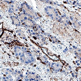 Immunohistochemistry CD39/ENTPD1 Antibody (3304A) [Unconjugated]