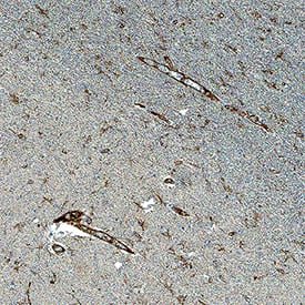 Immunohistochemistry CD39/ENTPD1 Antibody (3304A) [Unconjugated]