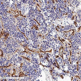 Immunohistochemistry CD39/ENTPD1 Antibody (3304A) [Unconjugated]