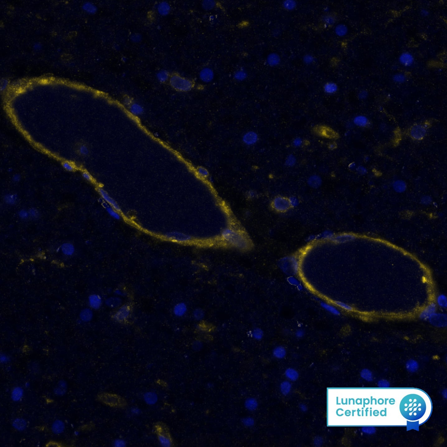 Multiplex Immunofluorescence CD39/ENTPD1 Antibody (3304A) [Unconjugated]