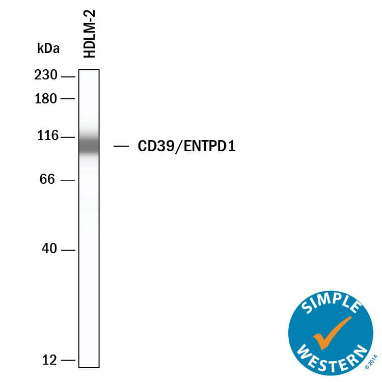 Simple Western CD39/ENTPD1 Antibody (3304A) [Unconjugated]