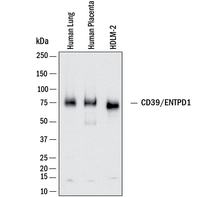 Western Blot CD39/ENTPD1 Antibody (3304A) [Unconjugated]