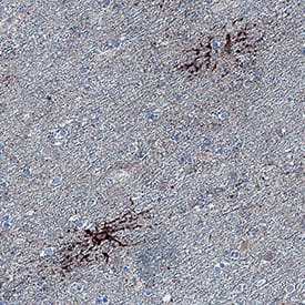 Aquaporin 4/AQP4 was detected in immersion fixed paraffin-embedded sections of human brain cortex using Rabbit Anti-Human Aquaporin 4/AQP4 Monoclonal Antibody (Catalog # MAB11748) at 3 µg/ml overnight at 4 &deg;C. Before incubation with the primary antibody, tissue was subjected to heat-induced epitope retrieval using VisUCyte Antigen Retrieval Reagent-Basic (Catalog # VCTS021). Tissue was stained using the HRP-conjugated Anti-Rabbit IgG Secondary Antibody (Catalog # HAF008) and counterstained with hematoxylin (blue). Specific staining was localized to astrocytes. View our protocol for Chromogenic IHC Staining of Paraffin-embedded Tissue Sections.