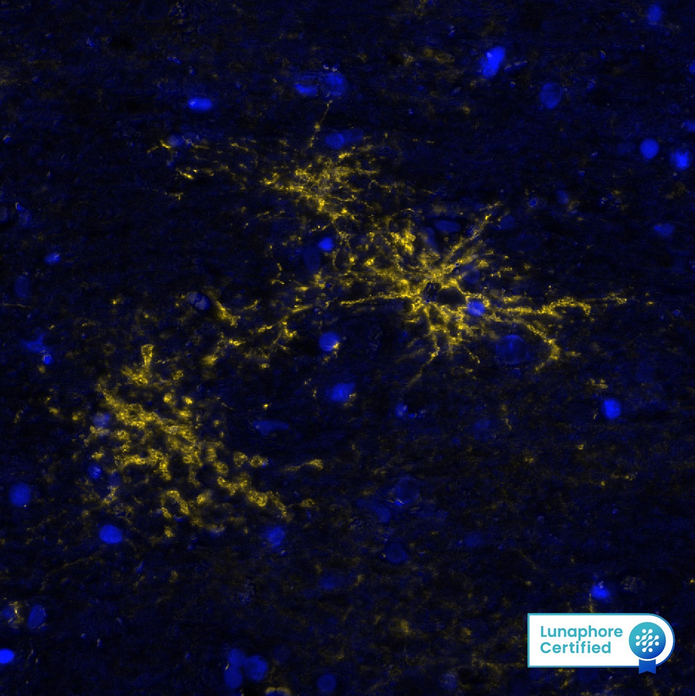 AQP4 was detected in immersion fixed paraffin-embedded sections of human Cortex using Rabbit Anti-Human AQP4, Monoclonal Antibody (Catalog #MAB11748) at 10ug/mL at 37 ° Celsius for 4 minutes. Before incubation with the primary antibody, tissue underwent an all-in-one dewaxing and antigen retrieval preprocessing using PreTreatment Module (PT Module) and Dewax and HIER Buffer H (pH 9; Epredia Catalog # TA-999-DHBH)Tissue was stained using the Alexa Fluor™ Plus 555 Goat anti-Rabbit IgG Secondary Antibody at 1:100 at 37 ° Celsius for 2 minutes. (Yellow; Lunaphore Catalog # DR555RB) and counterstained with DAPI (blue; Lunaphore Catalog # DR100). Specific staining was localized to the brain astrocytes. Protocol available in COMET™ Panel Builder.