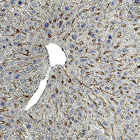 VEGFR2/KDR/Flk-1 was detected in perfusion fixed paraffin-embedded sections of mouse liver using Rabbit Anti-Mouse VEGFR2/KDR/Flk-1 Monoclonal Antibody (Catalog # MAB11749) at 0.5 µg/ml overnight at 4 °C. Before incubation with the primary antibody, tissue was subjected to heat-induced epitope retrieval using VisUCyte Antigen Retrieval Reagent-Basic (Catalog # VCTS021). Tissue was stained using the HRP-conjugated Anti-Rabbit IgG Secondary Antibody (Catalog # HAF008) and counterstained with hematoxylin (blue). Specific staining was localized to the cell surface of endothelial cells. View our protocol for Chromogenic IHC Staining of Paraffin-embedded Tissue Sections.