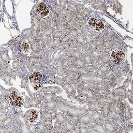 VEGFR2/KDR/Flk-1 was detected in perfusion fixed paraffin-embedded sections of mouse kidney using Rabbit Anti-Mouse VEGFR2/KDR/Flk-1 Monoclonal Antibody (Catalog # MAB11749) at 0.5 µg/ml overnight at 4 °C. Before incubation with the primary antibody, tissue was subjected to heat-induced epitope retrieval using VisUCyte Antigen Retrieval Reagent-Basic (Catalog # VCTS021). Tissue was stained using the HRP-conjugated Anti-Rabbit IgG Secondary Antibody (Catalog # HAF008) and counterstained with hematoxylin (blue). Specific staining was localized to the cell surface of endothelial cells. View our protocol for Chromogenic IHC Staining of Paraffin-embedded Tissue Sections.