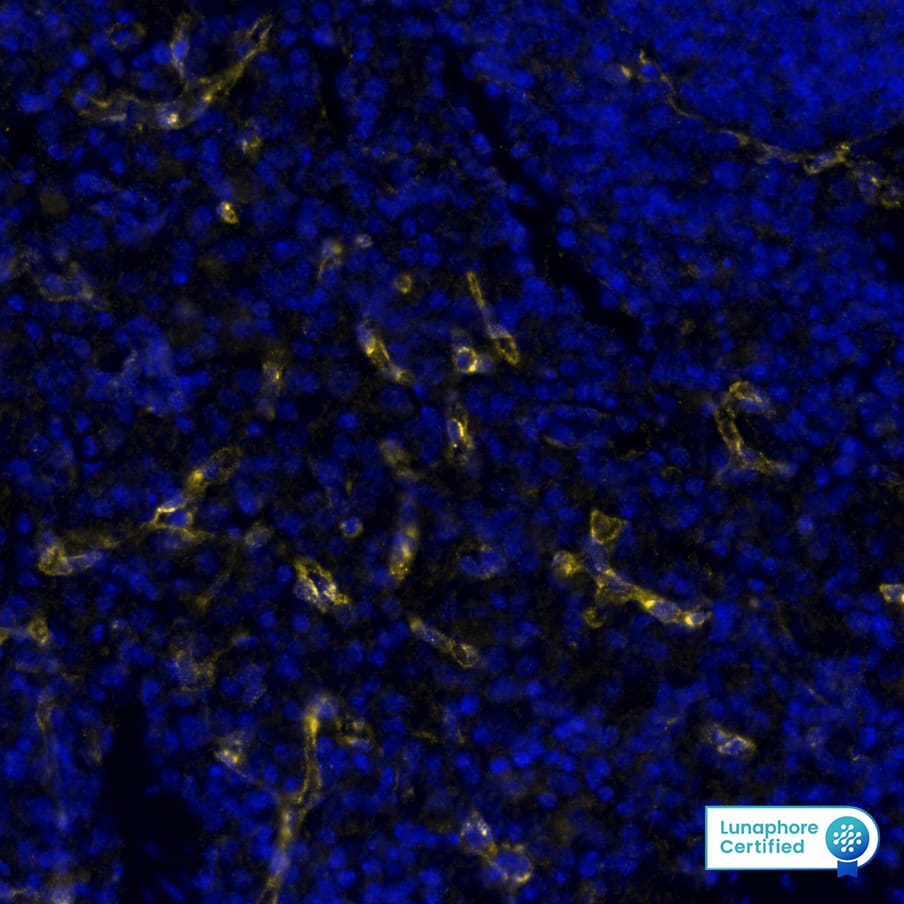 VEGFR2/KDR/Flk-1 was detected in immersion fixed paraffin-embedded sections of mouse spleen using Rabbit Anti-Mouse VEGFR2/KDR/Flk-1 , Monoclonal Antibody (Catalog #MAB11749) at 10ug/mL at 37° Celsius for 8 minutes. Before incubation with the primary antibody, tissue underwent an all-in-one dewaxing and antigen retrieval preprocessing using PreTreatment Module (PT Module) and Dewax and HIER Buffer H (pH 9; Epredia Catalog # TA-999-DHBH). Tissue was stained using the Alexa Fluor™ Plus 647 Goat anti-Rabbit IgG Secondary Antibody at 1:200 at 37 ° Celsius for 2 minutes. (Yellow; Lunaphore Catalog # DR647RB) and counterstained with DAPI (blue; Lunaphore Catalog # DR100). Specific staining was localized to the endothelial cells. Protocol available in COMET™ Panel Builder.