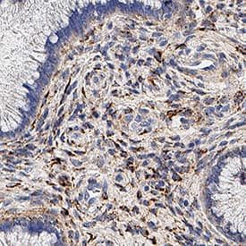 Collagen I  alpha 1 was detected in immersion fixed paraffin-embedded sections of human cervix using Rabbit Anti-Human Collagen I  alpha 1 Monoclonal Antibody (Catalog # MAB11757) at 3 µg/ml overnight at 4 °C. Before incubation with the primary antibody, tissue was subjected to heat-induced epitope retrieval using VisUCyte Antigen Retrieval Reagent-Basic (Catalog # VCTS021). Tissue was stained using the HRP-conjugated Anti-Rabbit IgG Secondary Antibody (Catalog # HAF008) and counterstained with hematoxylin (blue). Specific staining was localized to the cytoplasm. View our protocol for Chromogenic IHC Staining of Paraffin-embedded Tissue Sections.