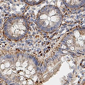 Collagen I  alpha 1 was detected in immersion fixed paraffin-embedded sections of human colon using Rabbit Anti-Human Collagen I  alpha 1 Monoclonal Antibody (Catalog # MAB11757) at 3 µg/ml overnight at 4 °C. Before incubation with the primary antibody, tissue was subjected to heat-induced epitope retrieval using VisUCyte Antigen Retrieval Reagent-Basic (Catalog # VCTS021). Tissue was stained using the HRP-conjugated Anti-Rabbit IgG Secondary Antibody (Catalog # HAF008) and counterstained with hematoxylin (blue). Specific staining was localized to the cytoplasm. View our protocol for Chromogenic IHC Staining of Paraffin-embedded Tissue Sections.