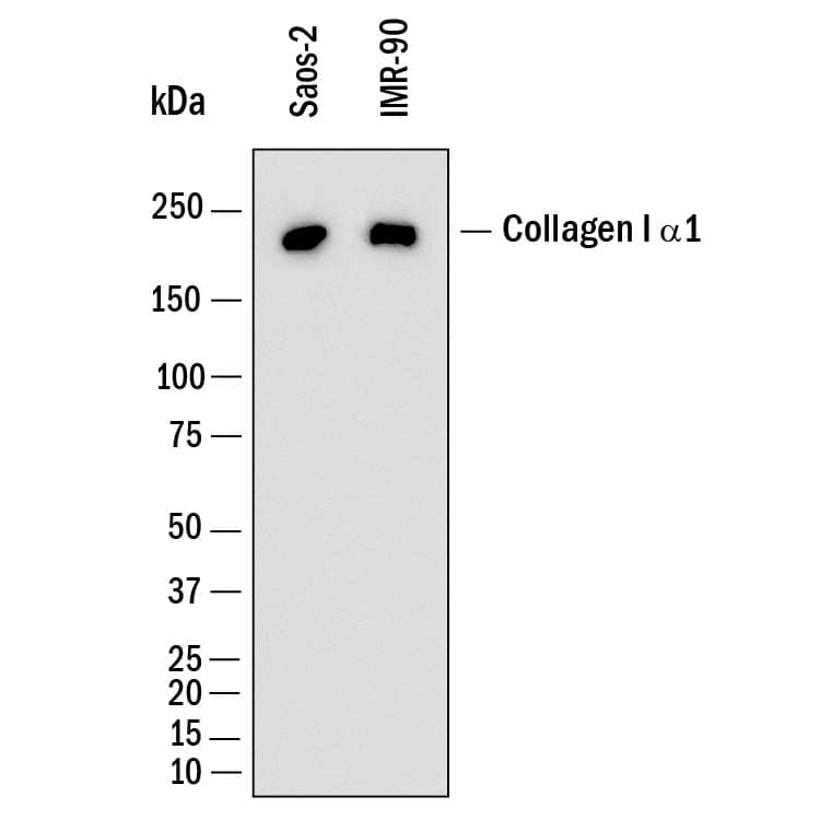 Western Blot shows lysates of Saos‑2 human osteosarcoma cell line and IMR‑90 human lung fibroblast cell line. PVDF membrane was probed with 1 µg/ml of Rabbit Anti-Human Collagen I  alpha 1 Monoclonal Antibody (Catalog # MAB11757) followed by HRP-conjugated Anti-Rabbit IgG Secondary Antibody (Catalog # HAF008). A specific band was detected for Collagen I  alpha 1 at approximately 220 kDa (as indicated).  This experiment was conducted under reducing conditions and using Western Blot Buffer Group 1.