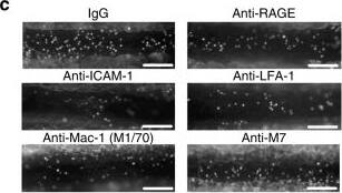 <b>Biological Strategies Validation. </b>Treatment with anti-M7 prevents inflammatory leukocyte recruitment in vitro and in vivo. a Murine peritoneal macrophages were incubated on dishes coated with mouse CD40L in the presence of 10μg/ml of IgG, anti-M7, or anti-Mac-1 (clone M1/70). Adhering cells were normalized to % of the IgG-treatment. b Murine RAW-cell adhesion on TNF alpha -primed murine endothelial cells under physiological flow in the presence of IgG or anti-M7 antibodies (10 μg/ml). c–f C57Bl/6 mice were injected i.p. with 200 ng TNF alpha  and 15 min before microscopy with Fab fragments of an IgG control antibody, or antibodies against RAGE, ICAM-1, LFA-1, Mac-1 (clone M1/70), or anti-M7 (100 μg i.p.). Leukocyte recruitment was monitored by intravital microscopy 4 h later: Adhering (d) and rolling leukocytes (e) were quantified as % of IgG. (f) Cumulative frequency of leukocyte rolling velocity. g Leukocyte adhesion in intravital microscopy in IgG or anti-M7 treated WT and Mac-1−/− mice. h, i Number of CX3CR1-GFP+ monocytes (white arrows) in the para-vascular space 4 h after treatment with IgG or anti-M7 and 200ng TNF alpha . j Confocal in vivo imaging of the greater omentum after local stimulation with TNF alpha  and i.v. injection of the indicated antibodies (100 μg) in LysM-GFP reporter mice. LysM-GFP+ myeloid cells were tracked over time. Time lapse and cell tracking is shown over 15 min (right panel). k Plasma cytokine levels of mice subjected to intravital microscopy after IgG or anti-M7 Fab treatment. l Peritoneal exudate cells (PECs) 72 h after induction of a sterile peritonitis and the indicated antibody treatment. Scale bars represent 100μm (c, h, j). Error bars indicate mean ± SEM. Statistical significance was assessed by a two-sided, unpaired Student’s T-test between the indicated groups (a, b, g, i, k, l) or in comparison to IgG-treatment (d, e). *P < 0.05, **P < 0.01, ***P < 0.001, ****P < 0.0001. N ≥ 3 independent experiments (a, b). N ≥ 10 mice per group (d, e, f, g), N ≥ 6 mice per group (l, h) Image co
