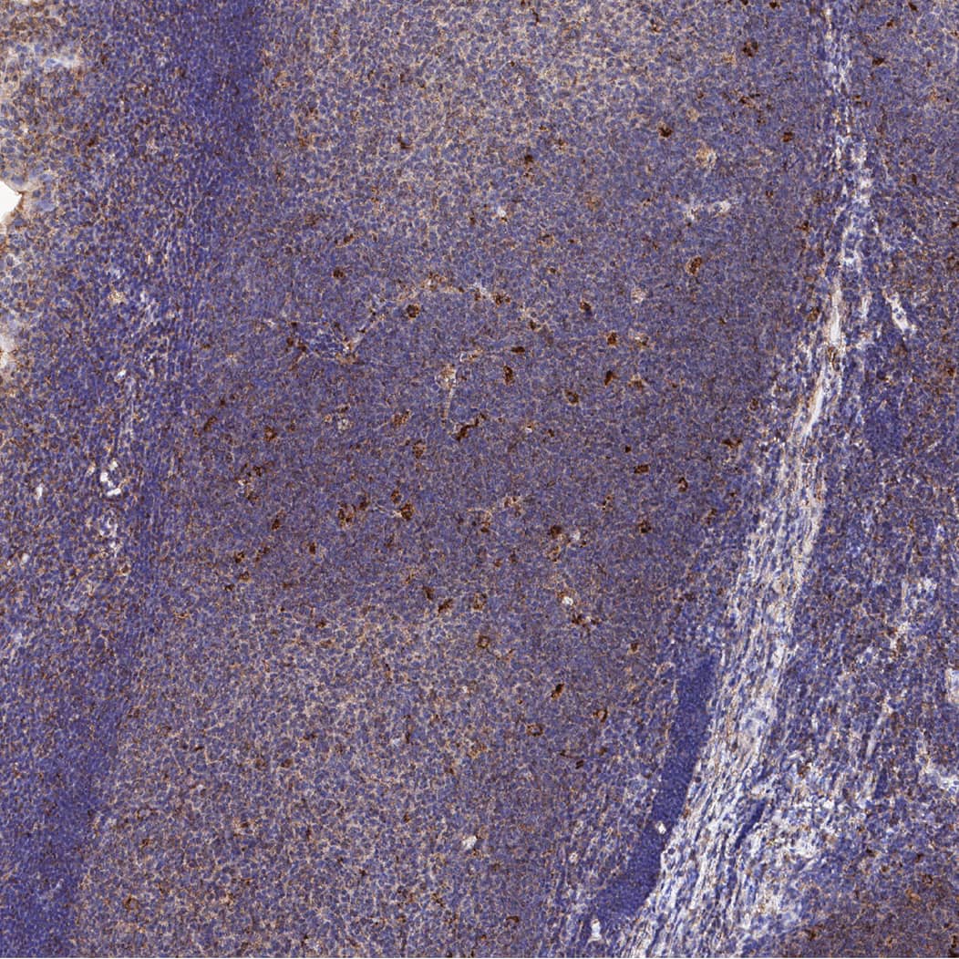 CTLA‑4 was detected in immersion fixed paraffin-embedded sections of human tonsil using Mouse Anti-Human CTLA‑4 Monoclonal Antibody (Catalog # MAB11809) at 5 µg/ml overnight at 4 &deg;C. Before incubation with the primary antibody, tissue was subjected to heat-induced epitope retrieval using VisUCyte Antigen Retrieval Reagent-Basic (<a class=