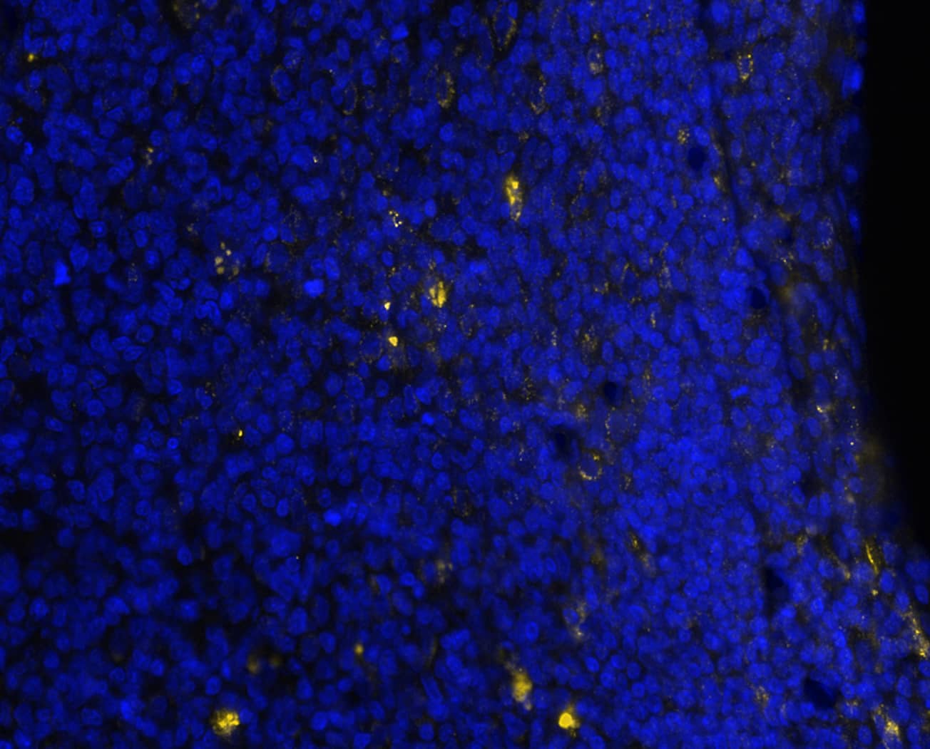 CTLA4 was detected in immersion fixed paraffin-embedded sections of human tonsil using Mouse Anti-Human CTLA4, Monoclonal Antibody (Catalog # MAB11809) at 3ug/mL at 37 ° Celsius for 4 minutes. Before incubation with the primary antibody, tissue underwent an all-in-one dewaxing and antigen retrieval preprocessing using PreTreatment Module (PT Module) and Dewax and HIER Buffer H (pH 9; Epredia Catalog # TA-999-DHBH). Tissue was stained using the Alexa Fluor™ 647 Goat anti-Mouse IgG Secondary Antibody at 1:200 at 37 ° Celsius for 2 minutes. (Yellow; Lunaphore Catalog # <A class=