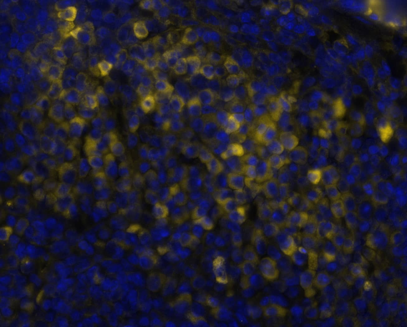 CTLA4 was detected in immersion fixed paraffin-embedded sections of human spleen using Mouse Anti-Human CTLA4, Monoclonal Antibody (Catalog # MAB11809) at 3ug/mL at 37 ° Celsius for 4 minutes. Before incubation with the primary antibody, tissue underwent an all-in-one dewaxing and antigen retrieval preprocessing using PreTreatment Module (PT Module) and Dewax and HIER Buffer H (pH 9; Epredia Catalog # TA-999-DHBH). Tissue was stained using the Alexa Fluor™ 647 Goat anti-Mouse IgG Secondary Antibody at 1:200 at 37 ° Celsius for 2 minutes. (Yellow; Lunaphore Catalog # <A class=