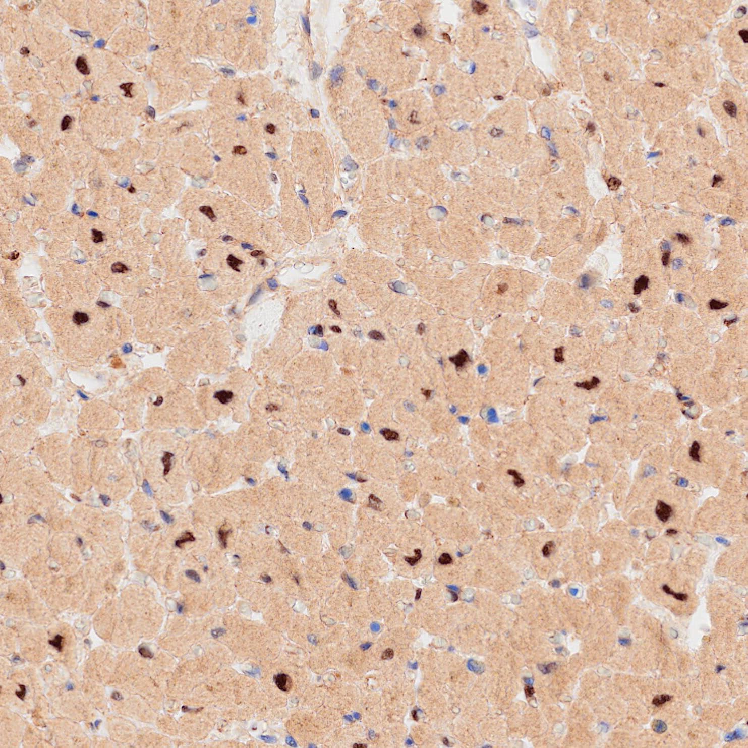 Immunohistochemistry RBM20 Antibody (1122808) [Unconjugated]