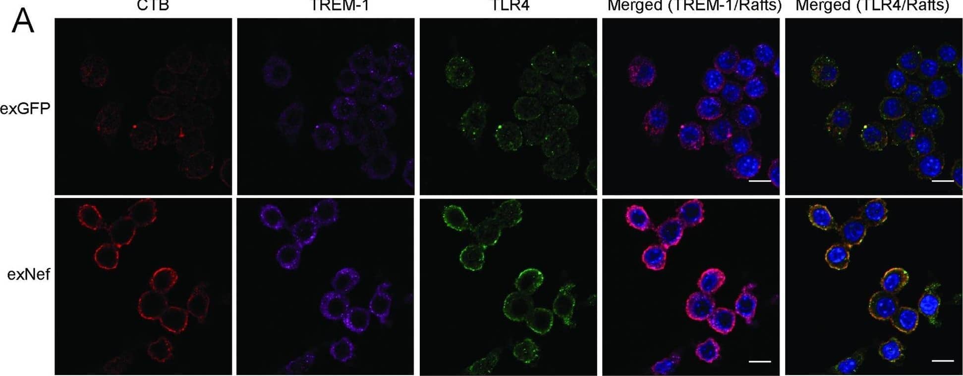 ExNef potentiate inflammatory signalling cascade via re-localization of TLR4 & TREM-1 to lipid rafts.A–The effect of exNef (0.4 ng/ml, 48h) on abundance of lipid rafts & re-localization of TLR4 & TREM-1 to the plasma membrane in RAW264.7 macrophages. Left column, CTB staining; second column, anti-TREM-1 staining; third column anti-TLR4 staining; fourth column–merge TREM-1/rafts, right column–merge TLR4/rafts. Scale bars 10 μm. Image collected & cropped by CiteAb from the following open publication (//pubmed.ncbi.nlm.nih.gov/31344124), licensed under a CC-BY license. Not internally tested by R&D Systems.
