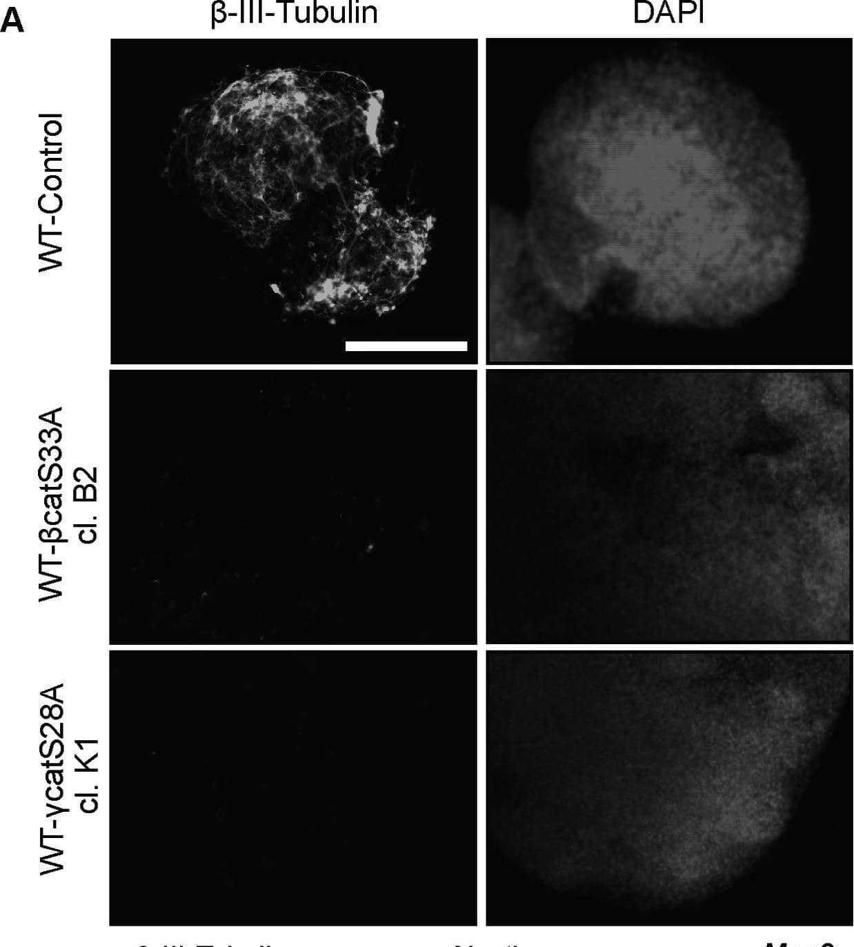 Stabilized  gamma -catenin suppresses neuronal differentiation in embryoid body assays and reduces overall tri-lineage differentiation efficiency.(A and B) Embryoid bodies were generated using control,  beta -catS33A, and  gamma -catS28A mESCs, and assayed for neuronal differentiation after 10 days. (A) Only WT EBs displayed immunofluorescent staining for the neuronal marker,  beta -III-tubulin. (B) The transcript levels of the neuronal markers  beta -III-tubulin, Nestin, Map2, Tyrosine hydroxylase, the endoderm marker  alpha -Fetoprotein, and the mesoderm marker Cardiac Troponin, were reduced in EBs derived from mESCs overexpressing  beta -catS33A or  gamma -catS28A, as assessed by qRT-PCR analyses. Bars represent means and error bars indicate s.e.m. (n = 2). Size bar  = 200 µm. Image collected and cropped by CiteAb from the following open publication (//pubmed.ncbi.nlm.nih.gov/23724138), licensed under a CC-BY license. Not internally tested by R&D Systems.