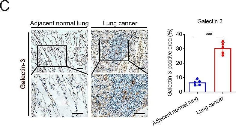 Immunohistochemistry Galectin-3 Antibody (202213) [Unconjugated]