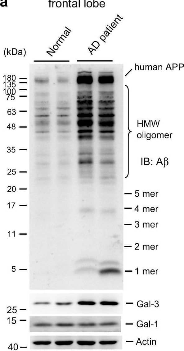 Western Blot Galectin-3 Antibody (202213) [Unconjugated]