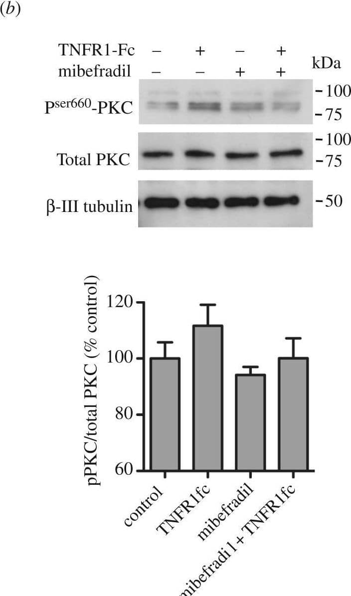 Western Blot IL-18 BPa/IL18BP Antibody (136033)